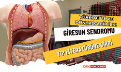 Türkiye’de ve Dünyada Bir İlk! Giresun Sendromu Tıp Literatürüne Girdi