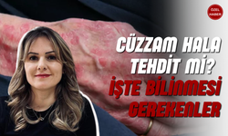 Cüzzam Hala Tehdit Mi? İşte Bilinmesi Gerekenler!