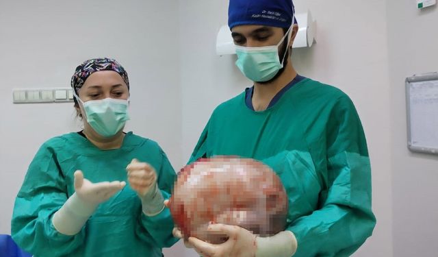 Karnı 2 ayda 9 aylık hamile gibi büyüyen kadının içinden karpuz kadar kitle çıkarıldı